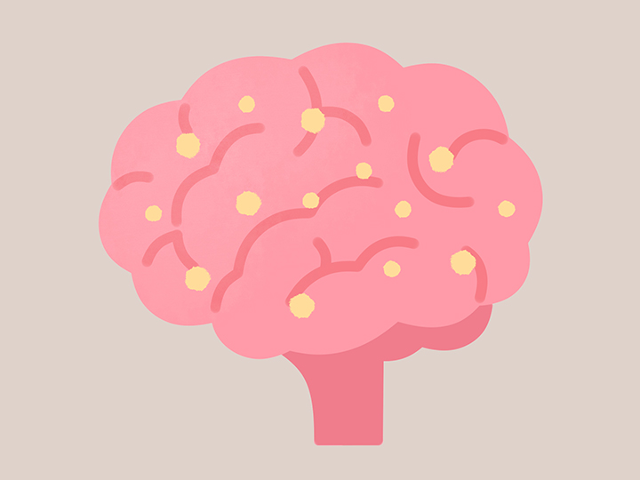 뇌의-단백질-덩어리