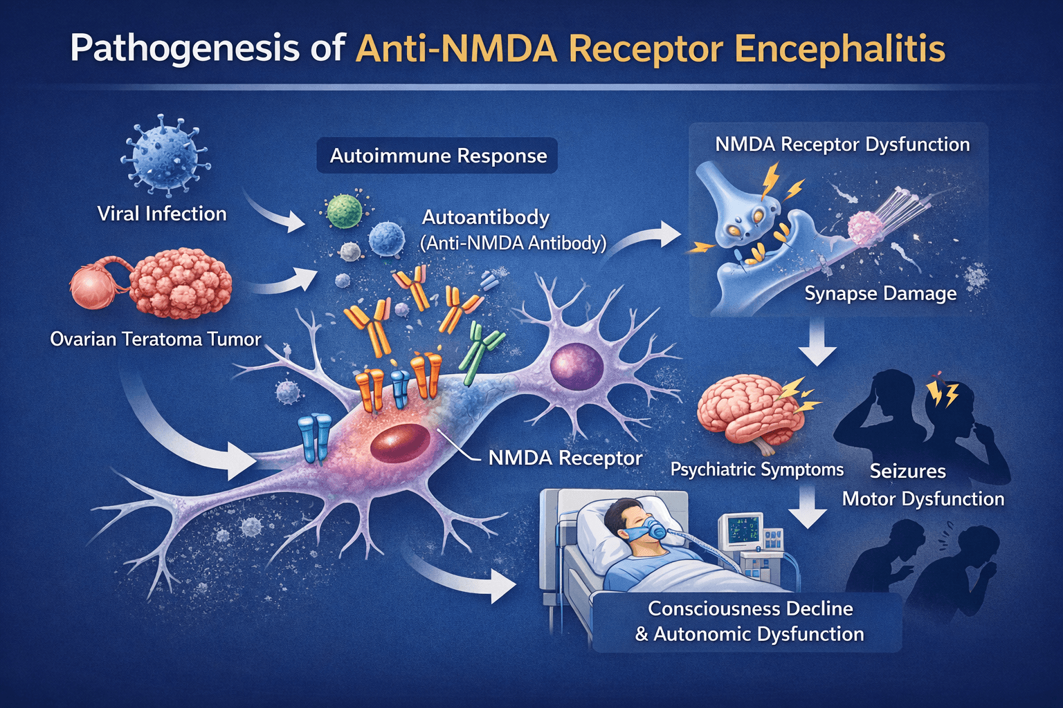 항NMDA 수용체 뇌염