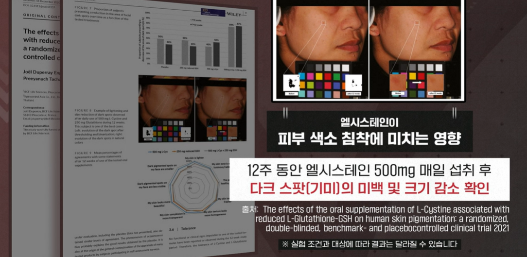 엘시스테인 효능
