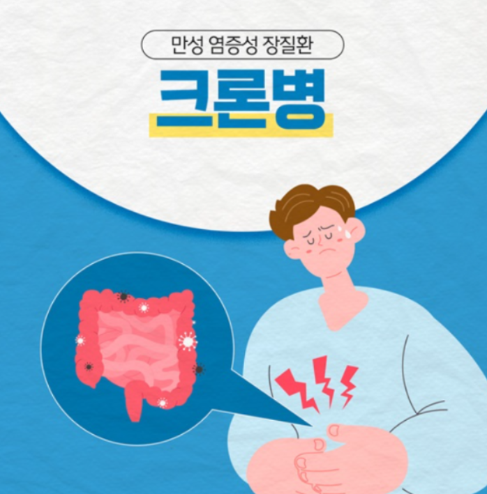 크론병