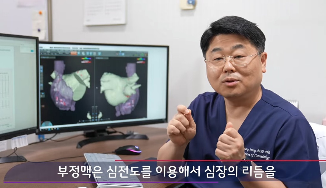 뇌졸중부르는심방세동-명의-정보영교수