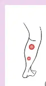손발 저림 원인