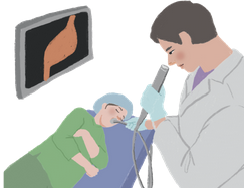 위산 역류 증상