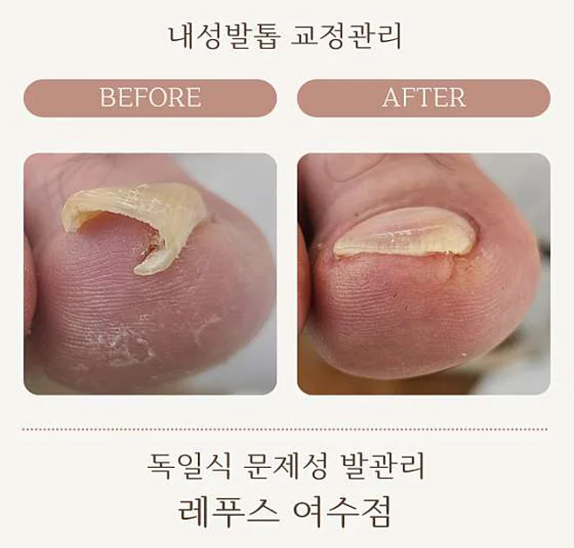 레푸스 여수웅천점