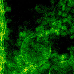 감염성 홍반 원인 - 바이러스