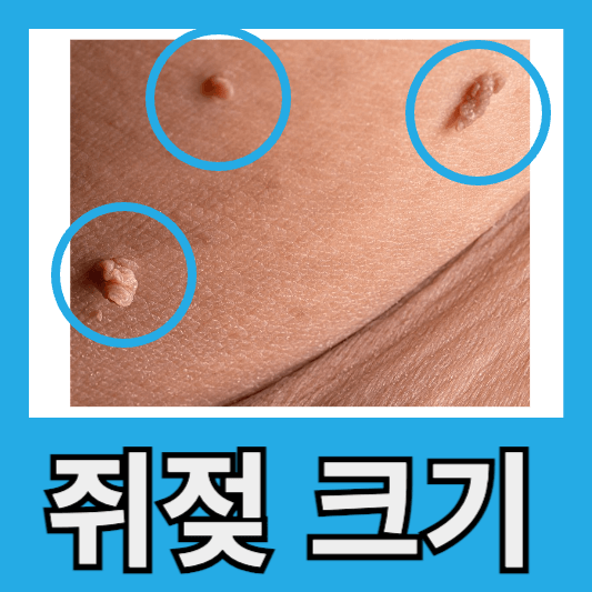 쥐젖 크기