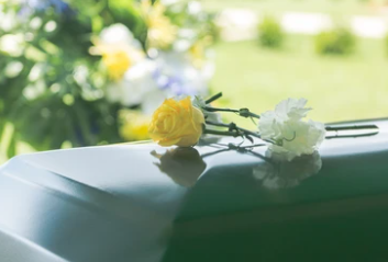 장기기증 사후처리