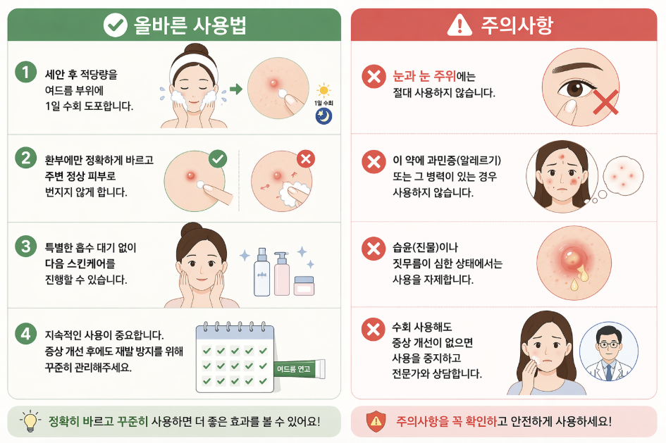 여드름 연고 사용법과 주의사항 인포그래픽으로 세안 후 도포 방법, 적정 사용량, 꾸준한 사용 중요성과 함께 눈가 사용 금지, 알레르기 및 염증 상태 주의사항을 정리한 이미지