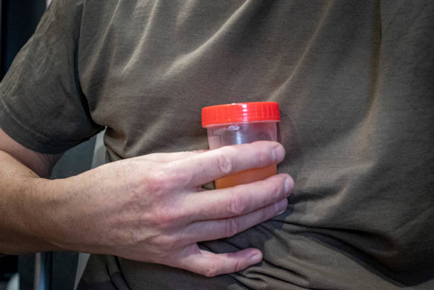 위산과다란? 원인과 증상