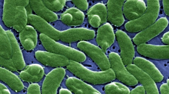 비브리오 패혈증 증상 18가지