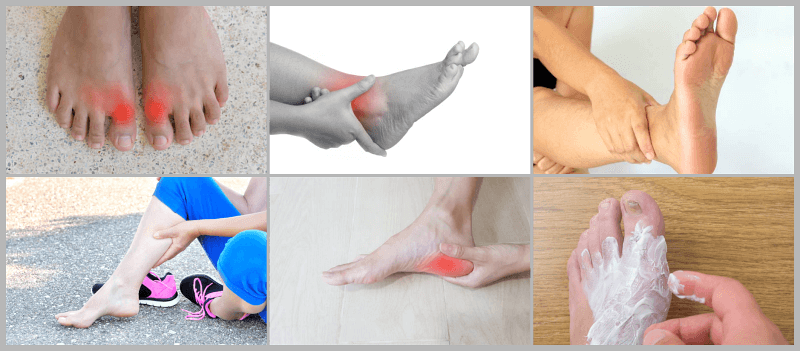 족저근막염 치료 방법 비용