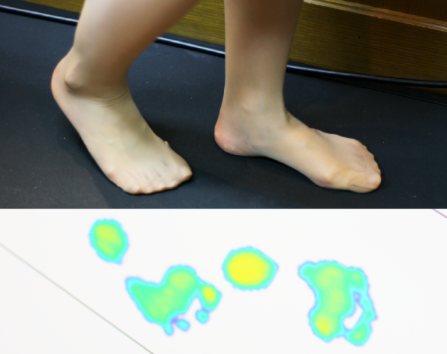 ▲전문 기계에서는&#44; 보행시 발바닥의 모습을 PC에 넣어 분석하는 사진