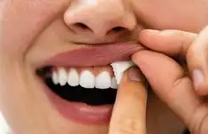 니코틴 중독 증상&amp;#44; 치료 방법
