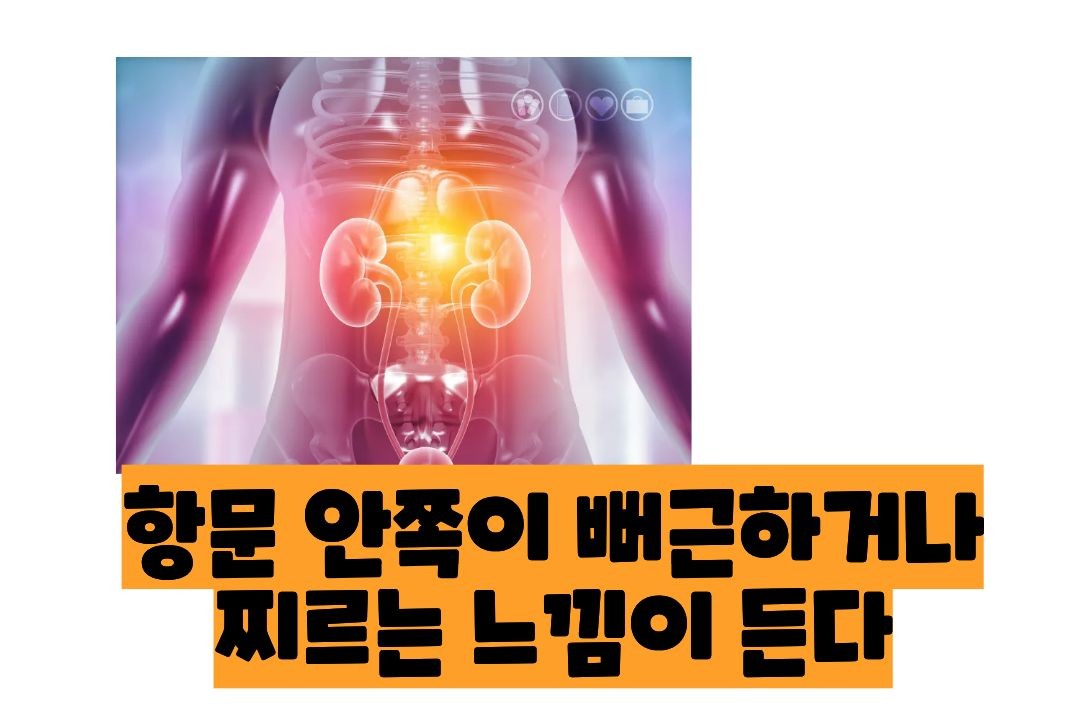 전립선염 증상