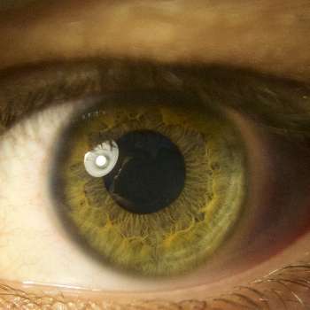 망막색소변성증