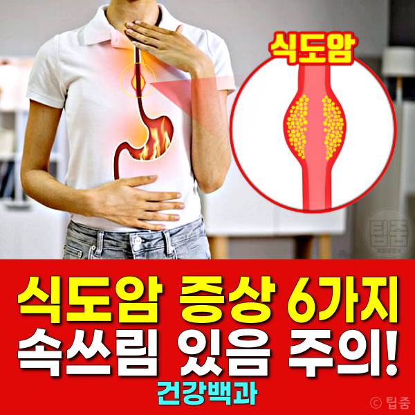 식도암 증상 속쓰림 식도암초기증상