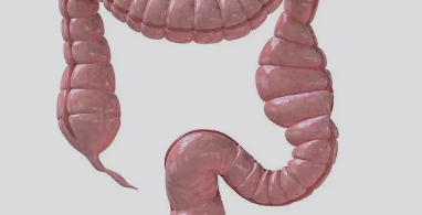 식이섬유가 부족한 고기 위주의 식단으로 인해 대장 내 압력이 높아져