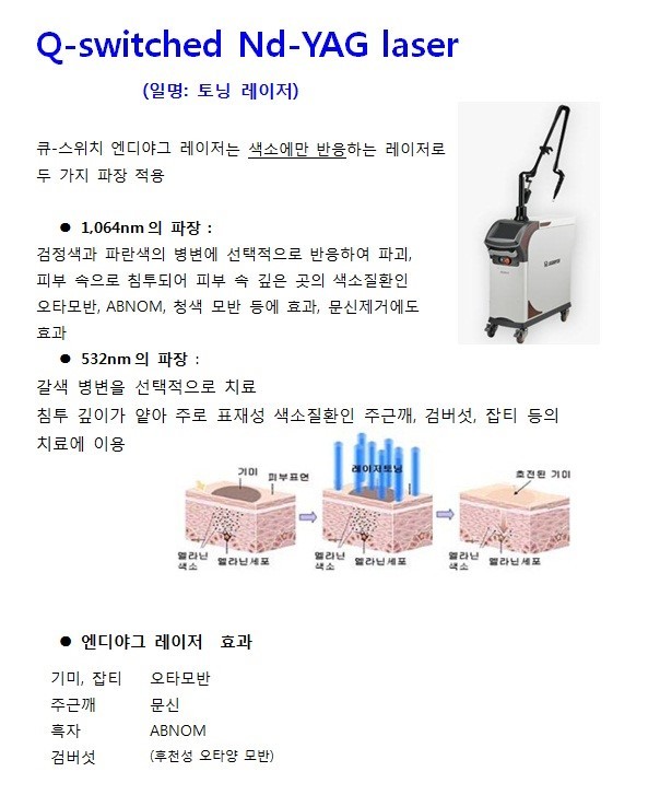 엔디야그 레이저 원리