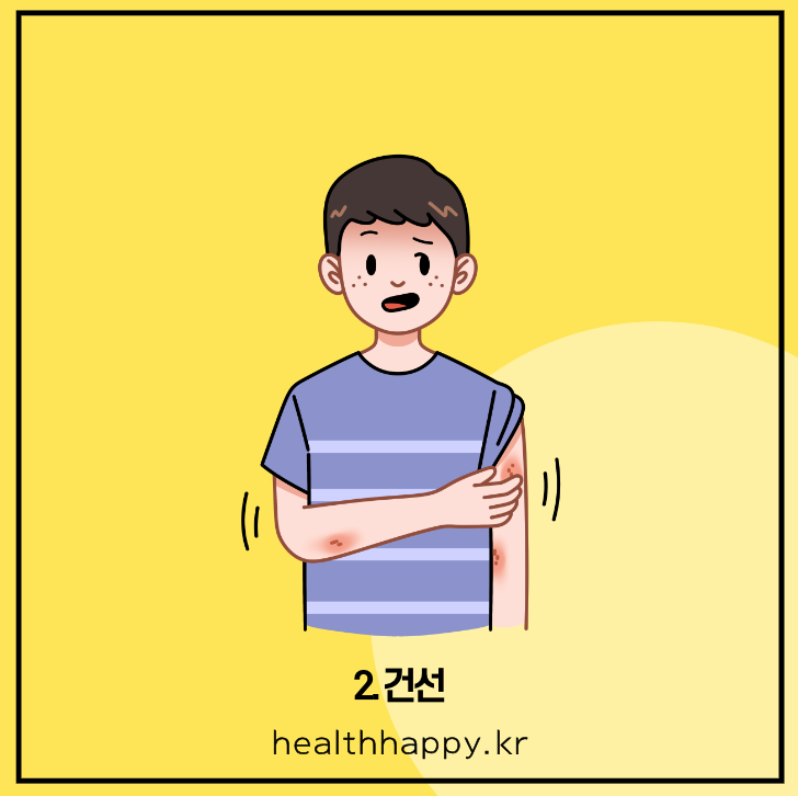2. 건선