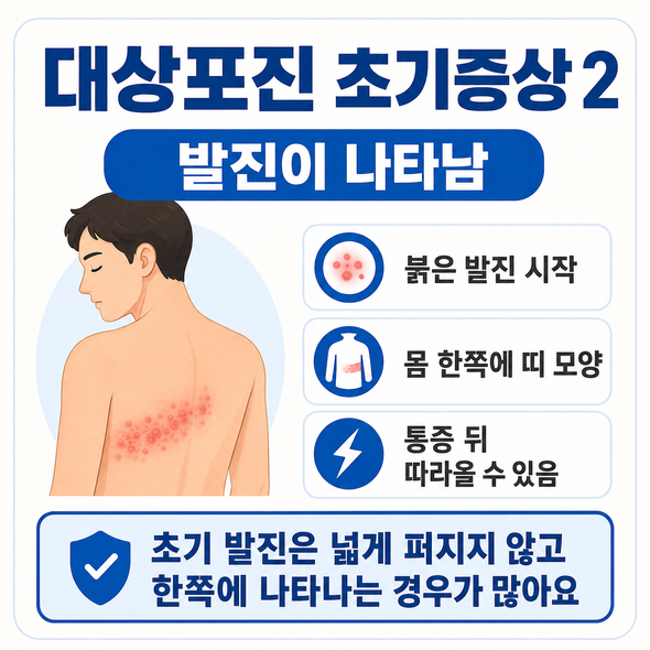 대상포진 초기증상