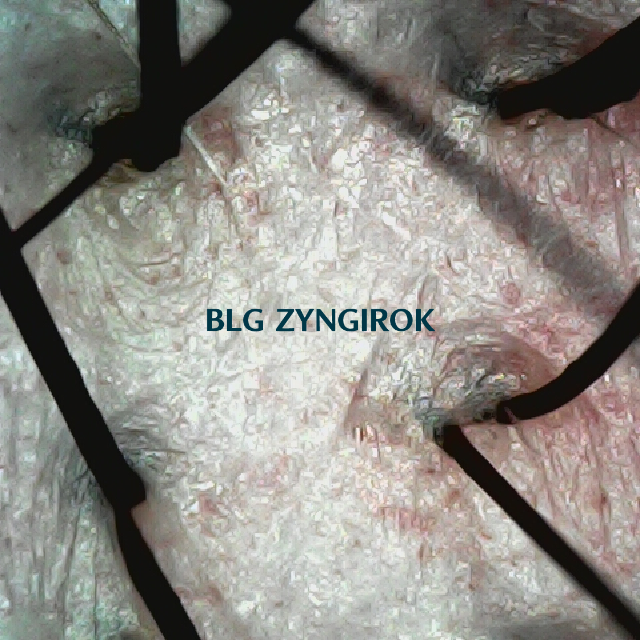 피나모아 복용 10주차 두피사진 - 뒷머리 부분 모습이다.