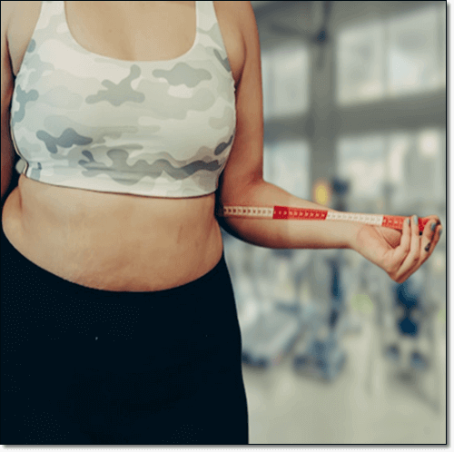 고도 비만 여성