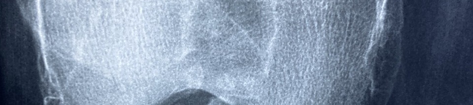 콘드로이친 효능 이미지