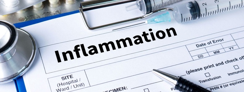 수면과 염증과의 관계 Connection between Sleep and Inflammatio