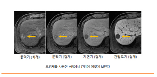 간암 환자 응급실 오는 9문 9답[김도영 교수]