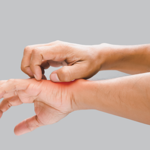 접촉성피부염증상 이게 시작이라니 피부염원인부터 관리법까지