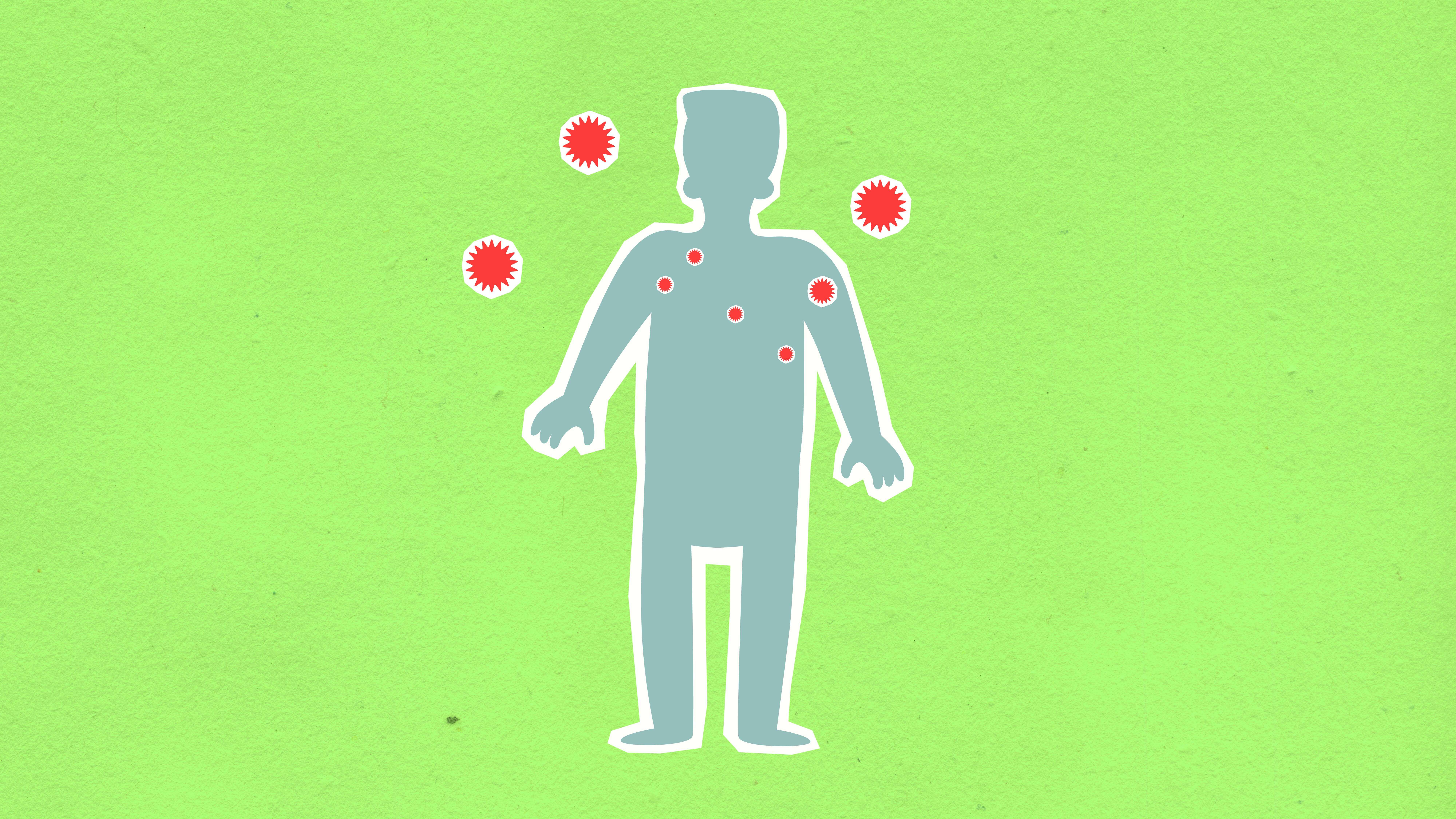 환절기 몸살 원인 총정리: 계절 바뀔 때 아픈 이유와 예방법