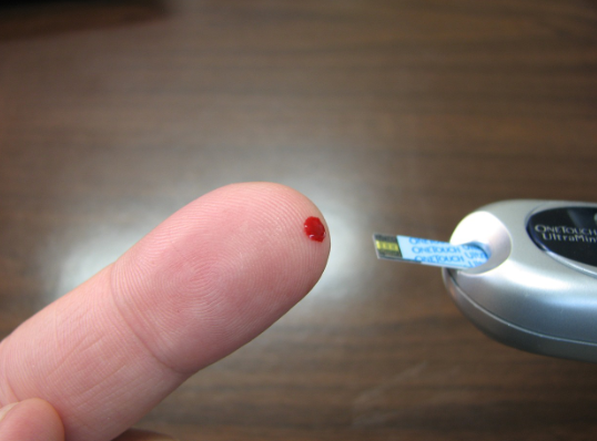 당뇨병성신경병증