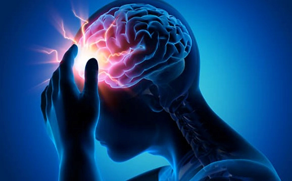 편두통 원인 10가지