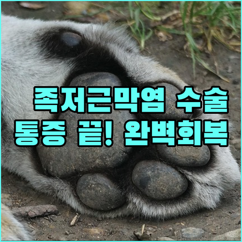 족저근막염 수술 방법과 회복 기간 및..
