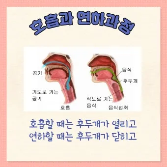 사래가 잘 걸리는 이유 사래 걸렸을때 대처법_10