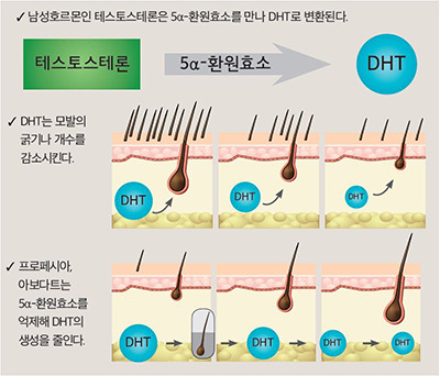 탈모 치료제 프로페시아