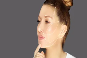 리프팅-시술-가격