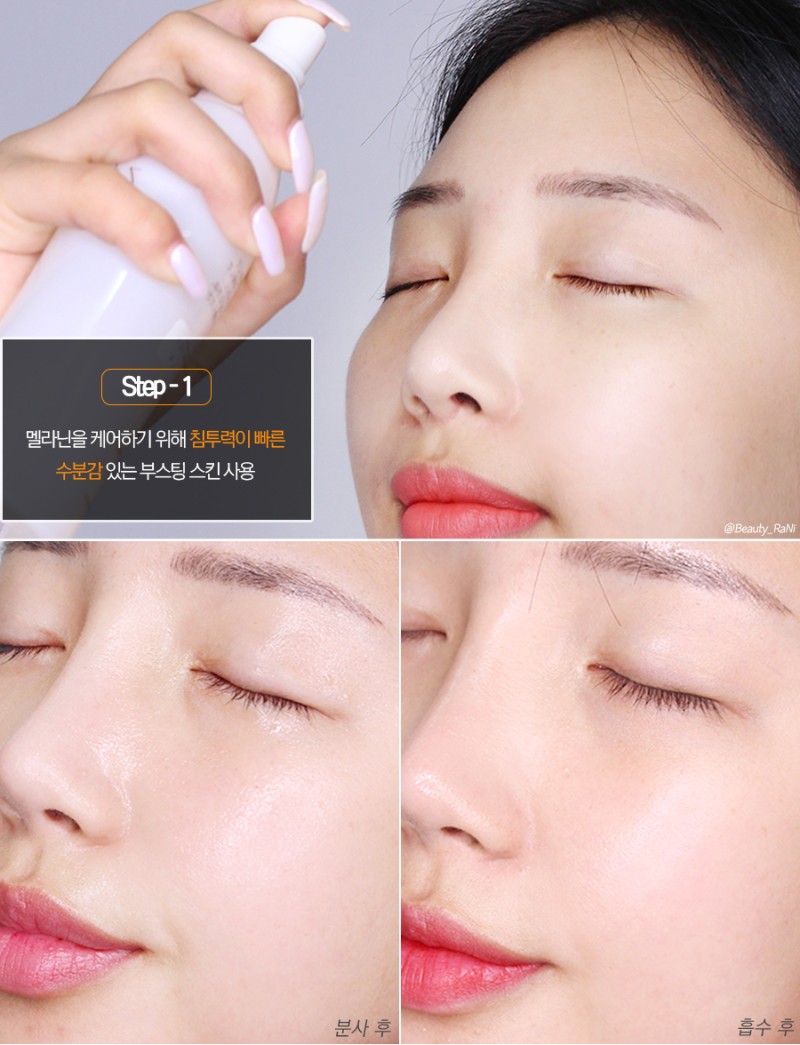 기미 없애는 방법