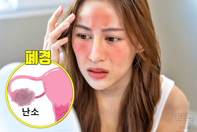 얼굴 붉은기 원인 얼굴 빨개지는 이유 얼굴홍조 원인 폐경