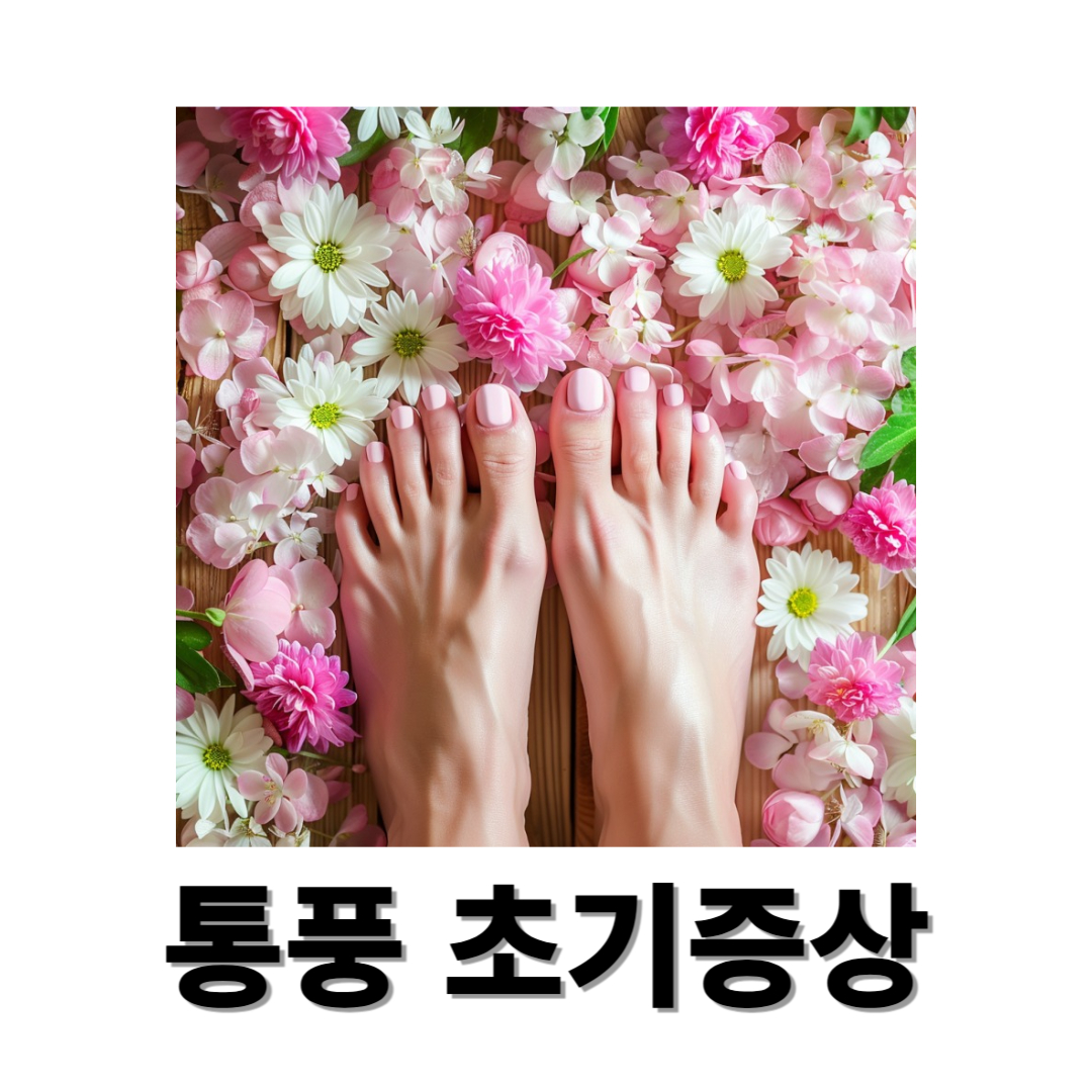 통풍과 관련된 사진입니다.