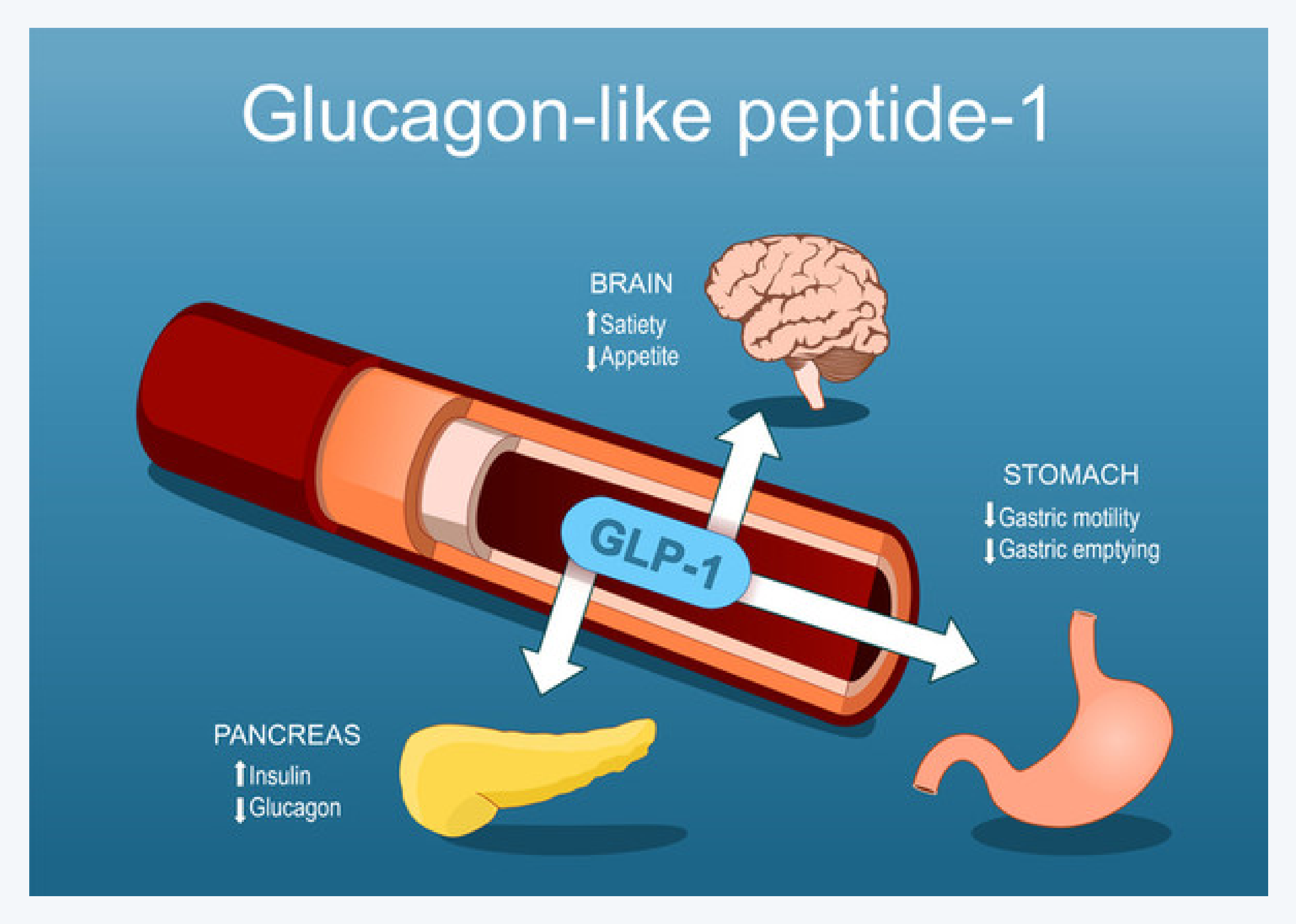 위고비, 다이어트