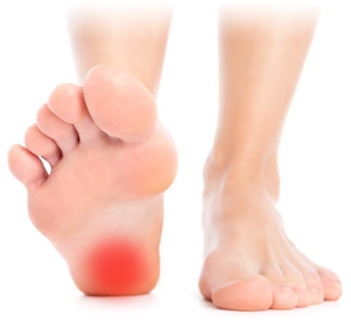 족저근막염 치료