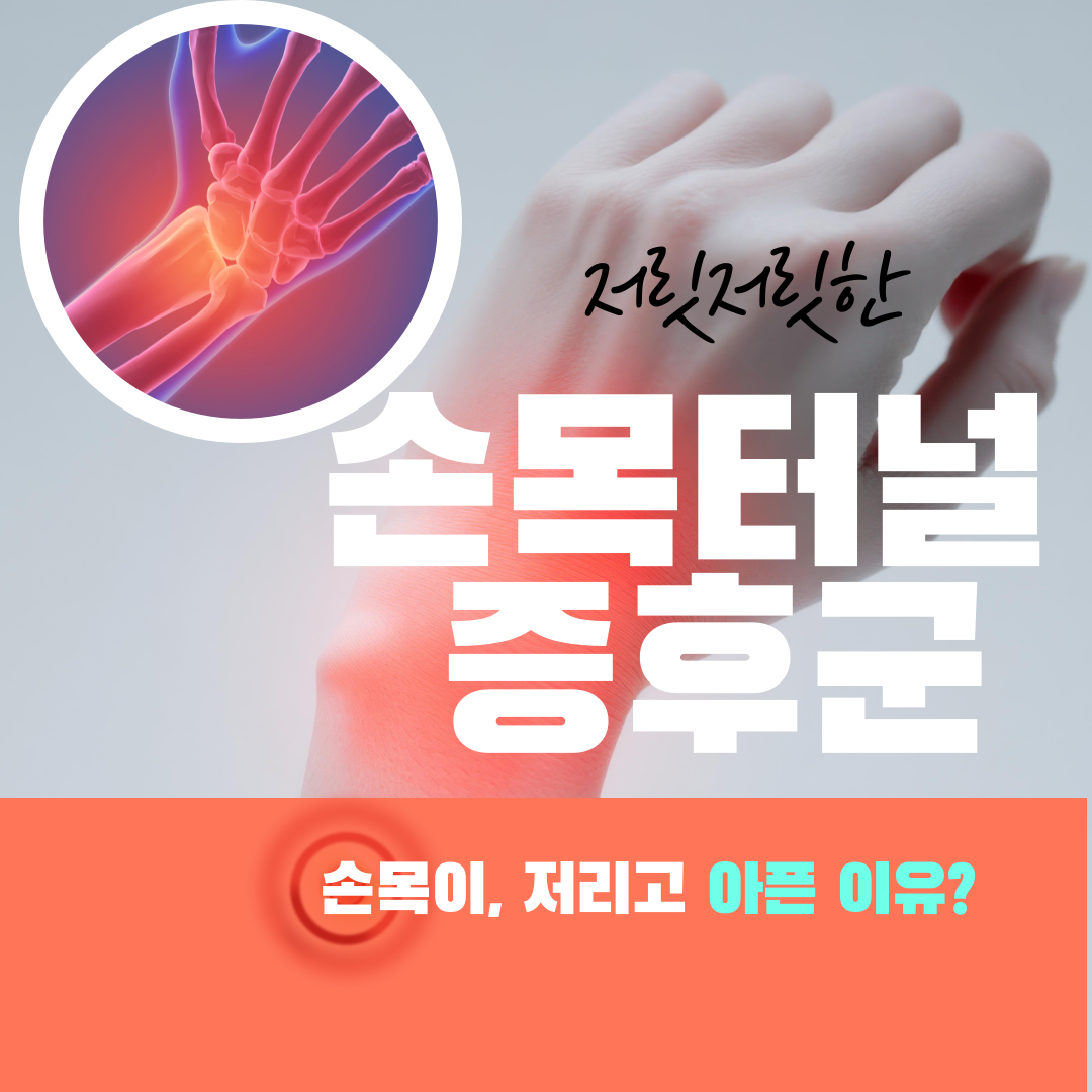 손목이 저리고 아픈 이유? 손목터널증후군 알아보기