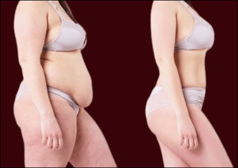 삭센다 다이어트