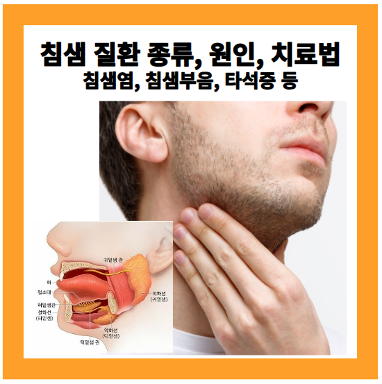 침샘 질환