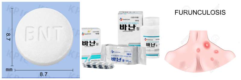 바난정, 종기 사진