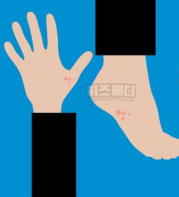 맥시부펜 시럽 용량