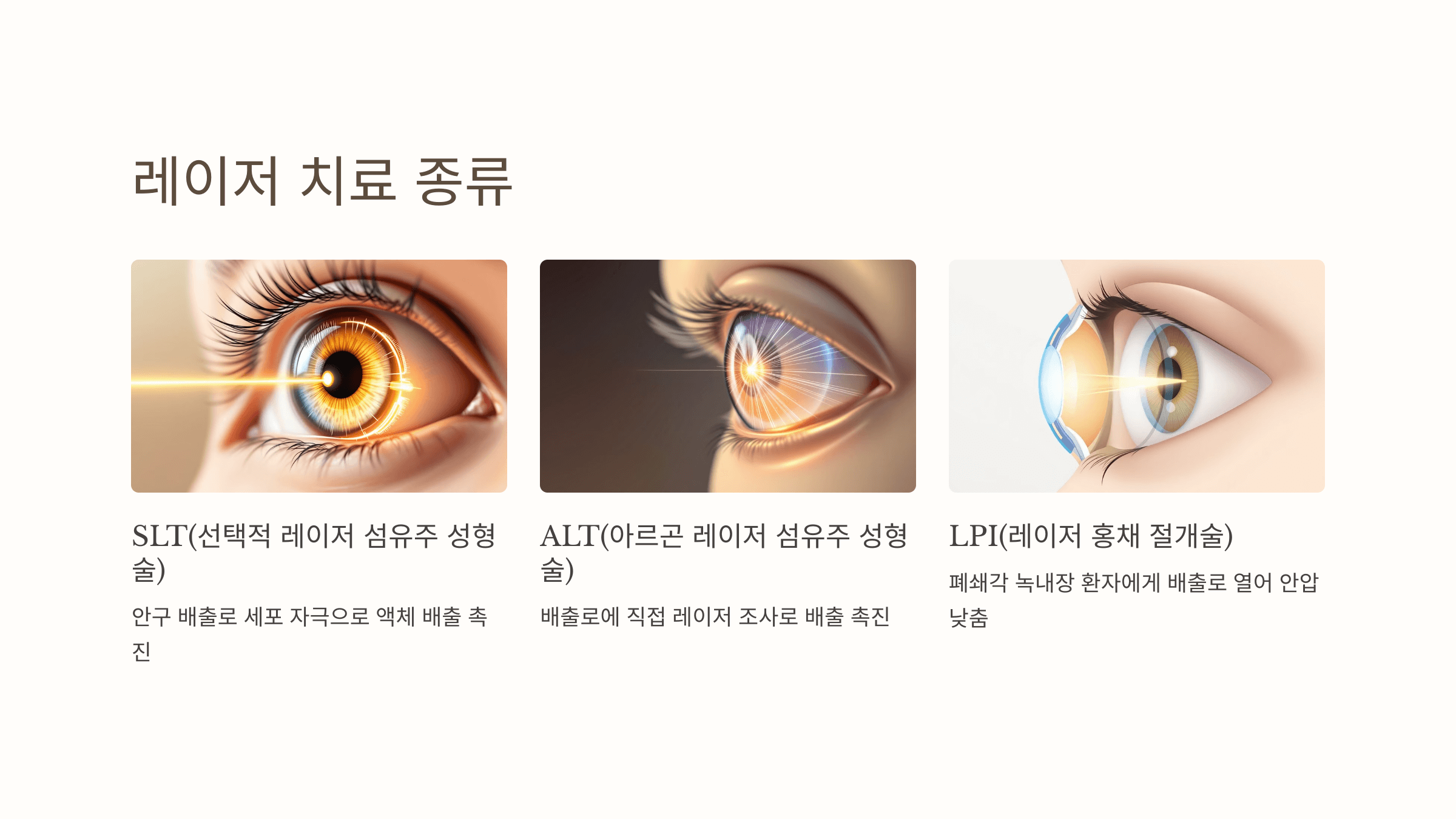 녹내장과 관련된 사진입니다.