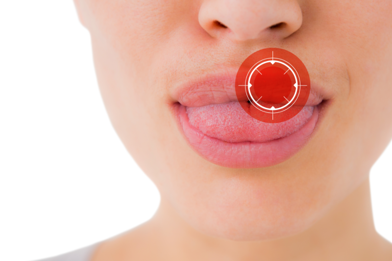 혀 통증 원인 혓바늘이 돋는 이유 혀 끝, 옆, 밑, 안쪽, 뿌리