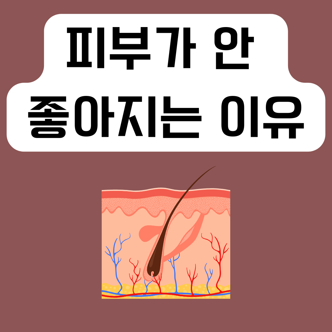 피부-요인들